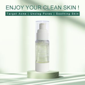 Acne Treatment Facial Serum