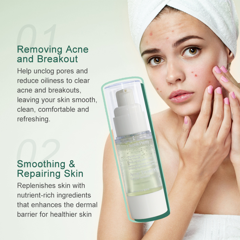 Acne Treatment Facial Serum