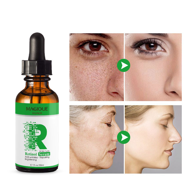 Interpretation of super anti-aging ingredients, which ones work