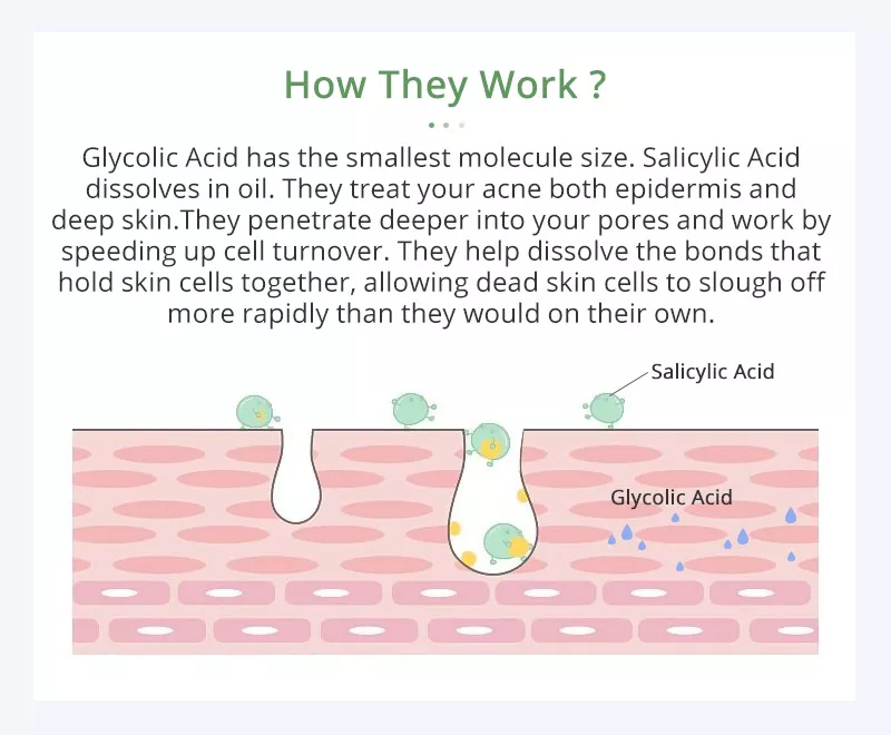 Salicylic Acid Anti-Acne Sheet Mask