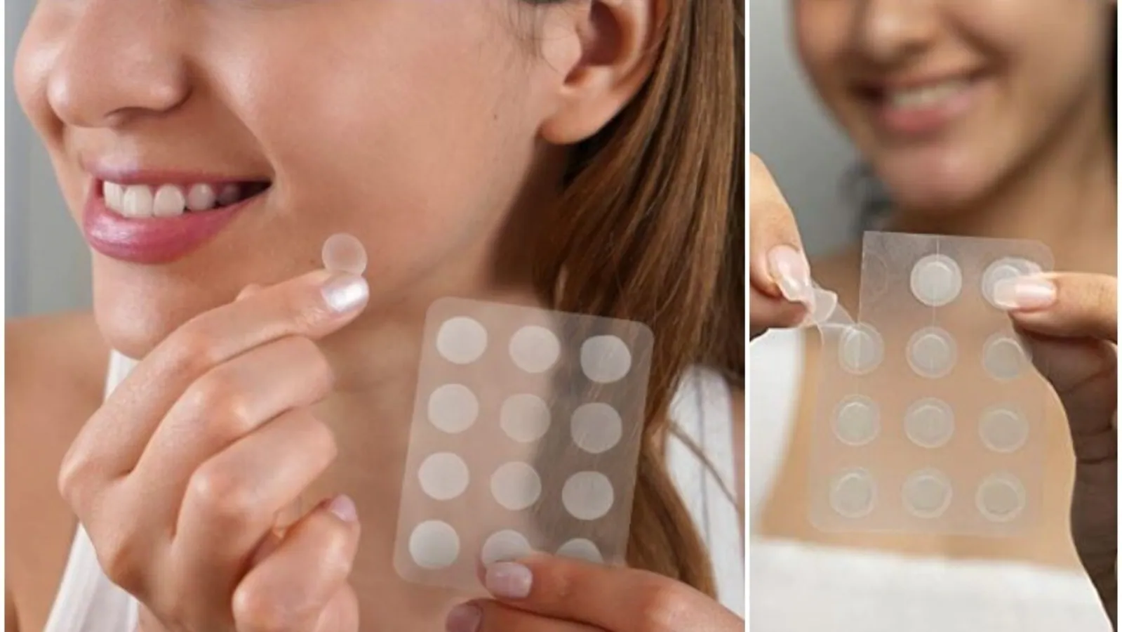 New fashion trend! Acne patch!